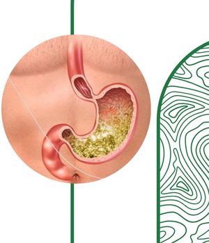آمادگی‌های لازم برای انجام عکس باریم میل