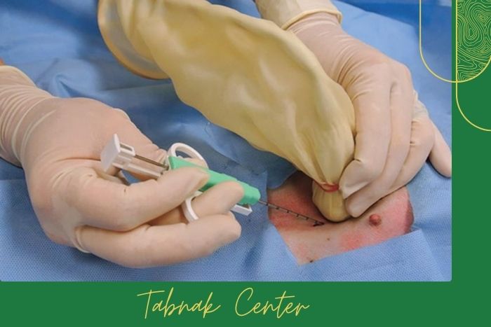 آیا نمونه ‌برداری درد دارد؟