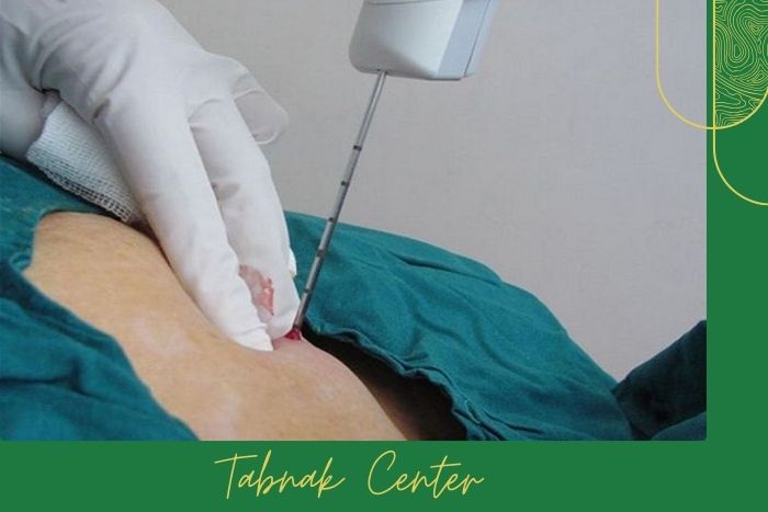 روش‌ های رایج بیوپسی در تشخیص ضایعات