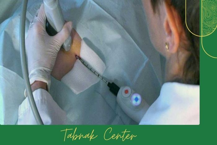 روش‌ های رایج بیوپسی در تشخیص ضایعات