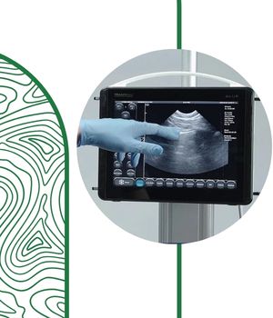 مزایا و محدودیتها مزایا و محدودیتها