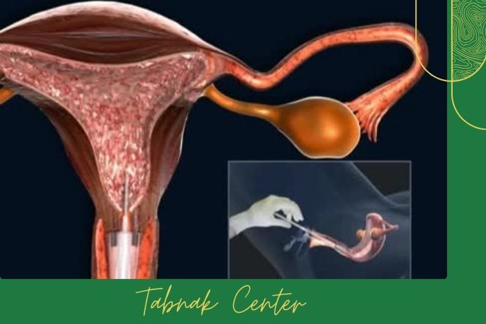 عوامل مؤثر بر میزان درد
