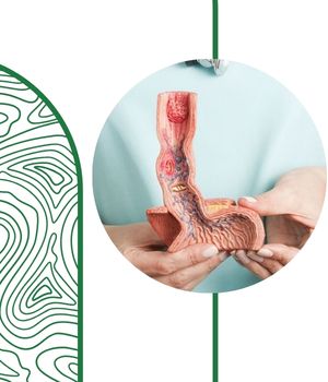 عکس رنگی مری چیست و چه کاربردی دارد؟