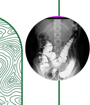 عکس رنگی معده چیست و چه کاربردی دارد؟