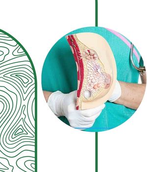 مراحل انجام خارج کردن مایع کیست سینه