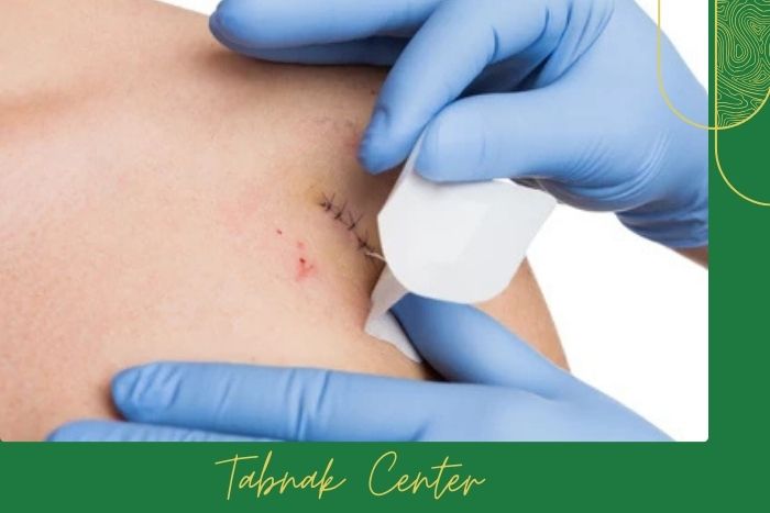 مراقبت ‌های ضروری بعد از نمونه ‌برداری