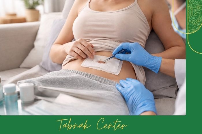 مراقبت ‌های ضروری بعد از نمونه ‌برداری