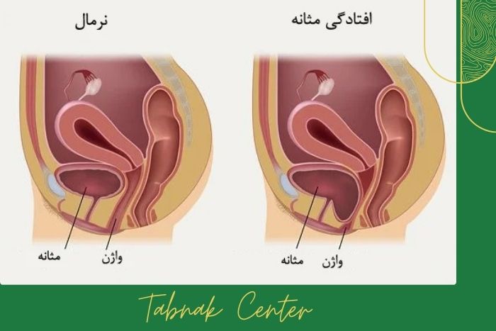 موارد کاربرد و تجویز تصویربرداری کف لگن موارد کاربرد و تجویز تصویربرداری کف لگن