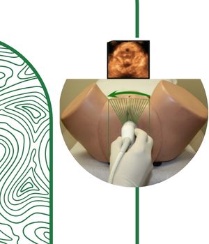 نحوه انجام سونوگرافی لبیال نحوه انجام سونوگرافی لبیال