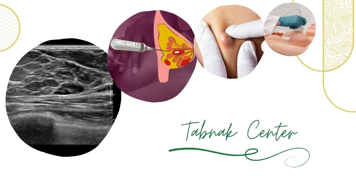 چرا مرکز تابناک بهترین مرکز تخلیه کیست سینه در تهران است؟