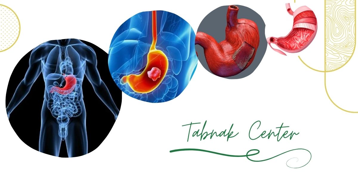 چرا مرکز تابناک بهترین مرکز عکس رنگی معده در تهران است؟