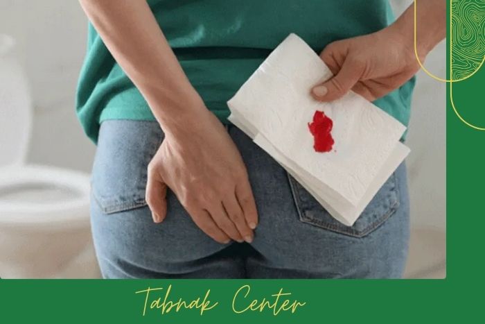 چه زمانی انجام باریم انما توصیه می‌شود؟