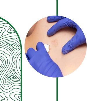 چه کارهایی بعد از بیوپسی نباید انجام داد؟