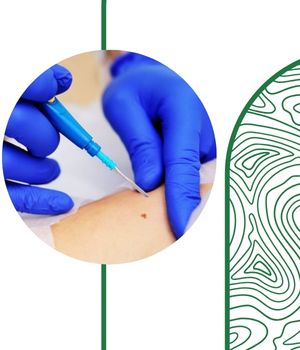 کاربردهای اصلی تخلیه کیست پستان