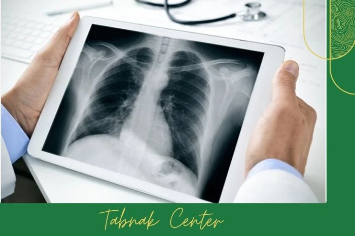 رادیوگرافی چیست و چگونه انجام میشود؟ رادیوگرافی چیست و چگونه انجام میشود؟